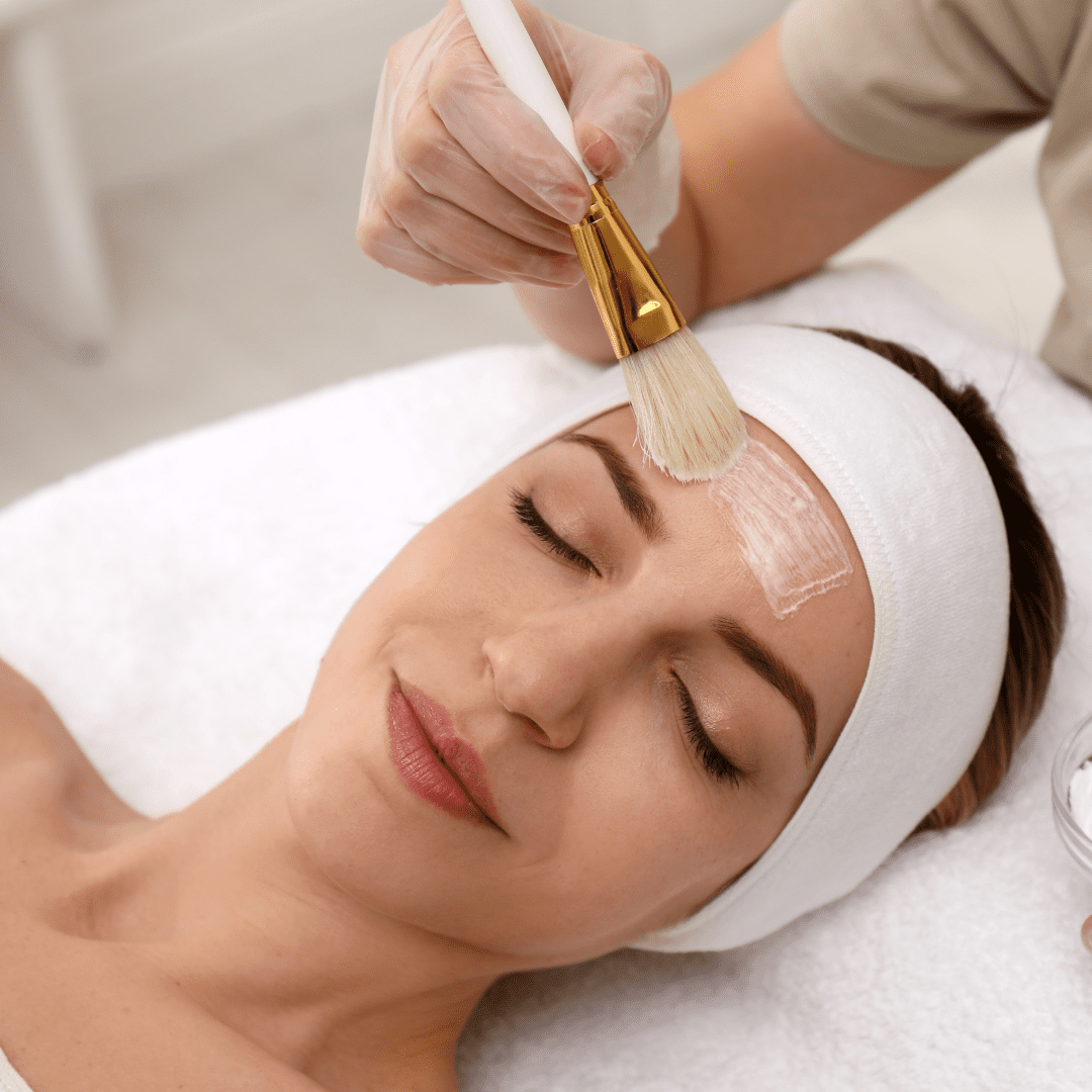 Application of a chemical peel to the face, one of the exfoliating treatments offered at River Cottage Beauty Salon in Hamstreet, part of our specialist skin treatments in Kent.