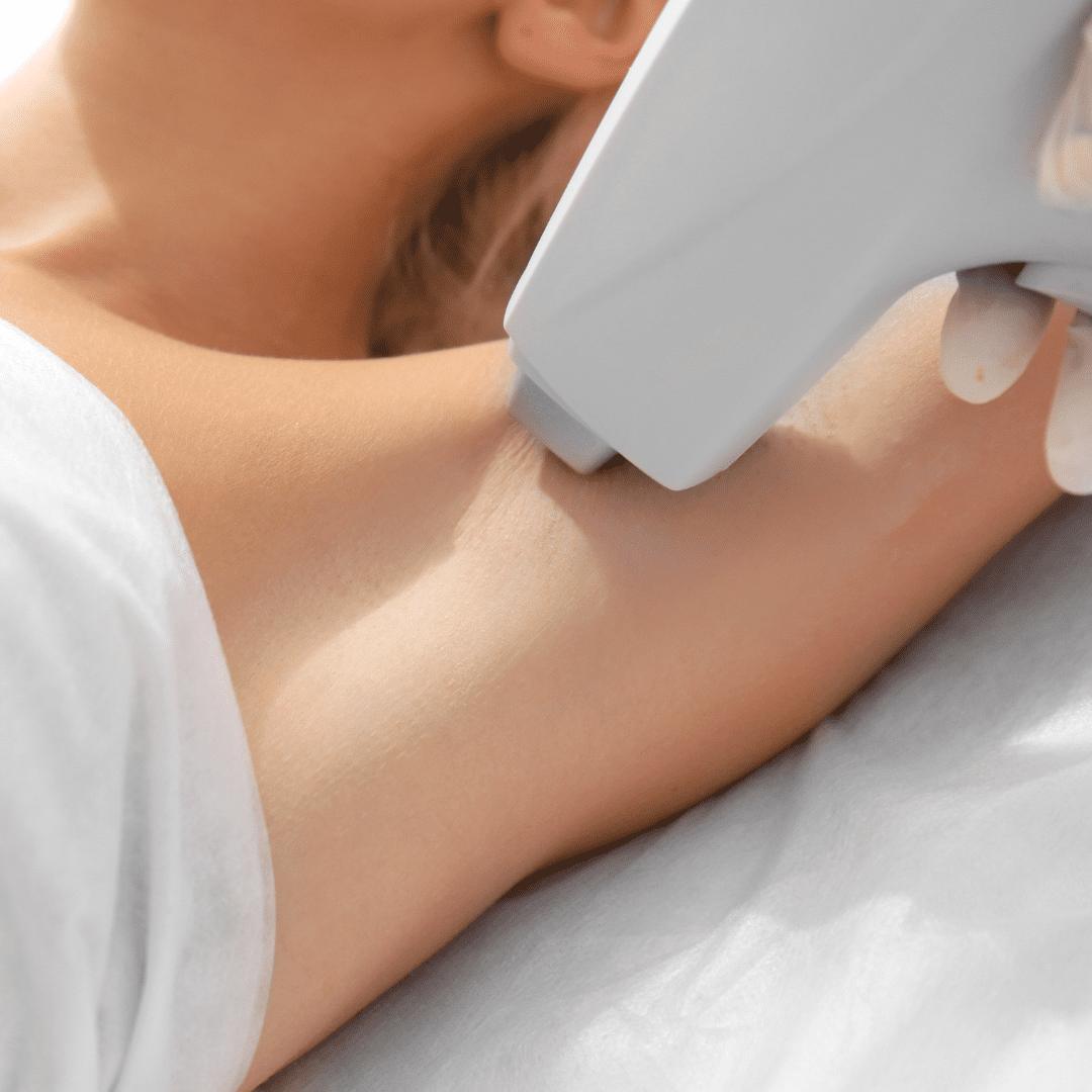 Underarm laser hair removal performed at River Cottage Beauty Salon in Hamstreet, part of our expert hair removal Kent services.